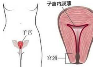 结婚5年怀孕2次都没成功，我的孩子去哪了？
